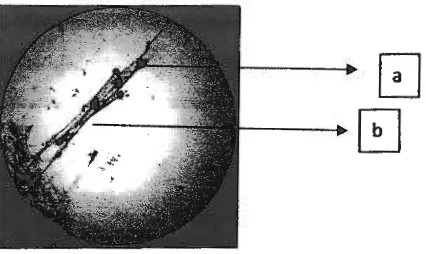Gambar 7. Penampakan Aspergillus sp. Dibawah mikroskop (perbesaran 10 kali) (a. Spora, b