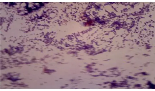Gambar 16. Corynebacterium glutamicum FHCC-0062 pada Pengamatan  Mikroskopik Perbesaran 1000x  