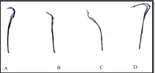 Gambar  2.1.  Morfologi  sperma  mencit  (Hayati  et  al.,  2005).  Gambar  A  adalah  sperma normal dengan kepala seperti kait pancing, gambar B, C dan  D  adalah  sperma  abnormal  (B=  sperma  dengan  kepala  seperti  pisang,  C=  sperma  tidak  beratur
