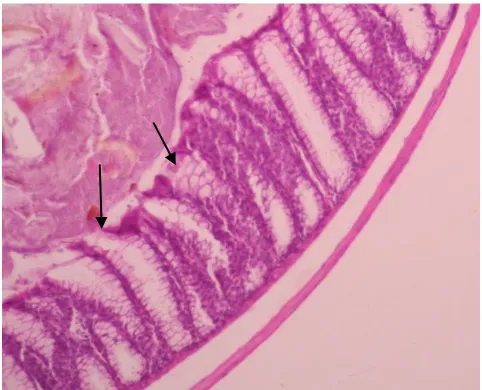 Gambar 5    Gambaran Histopatologik Mukosa Kolon Sigmoid pada Kelompok Ara-3 