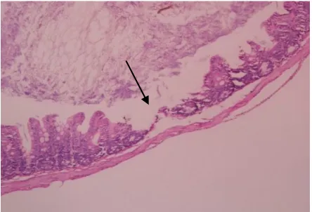 Gambar 2 Gambaran Histopatologik Mukosa Kolon Sigmoid pada Kelompok K-ARA 