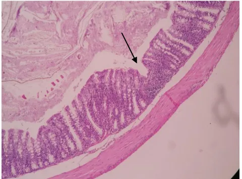 Gambar 3  Gambaran Histopatologik Mukosa Kolon Sigmoid Pada Kelompok Ara– 1 