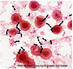 Gambar 1. Koloni Enterococcus faecalis dengan scanning electron microscope. 20 