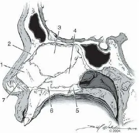Gambar 2.3. Anatomi Hidung, Septum nasi (1), kartilago kuadrangularis 
