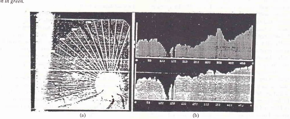 Figure 7- Experinental result. (a) shov,s the radial projection on the retinal inage. The original intage is color photograph