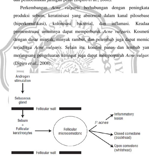 Gambar 2.2. Pengaruh utama dalam pembentukan lesi jerawat (Dipiro et al., 2008) 