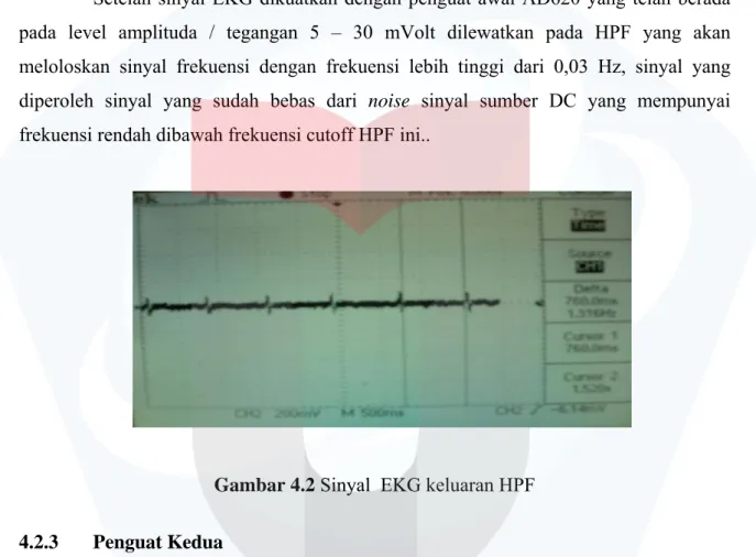 Gambar 4.1 Sinyal EKG keluaran AD620 penguat diferensial  4.2.2  High Pass Filter 0,03 Hz 