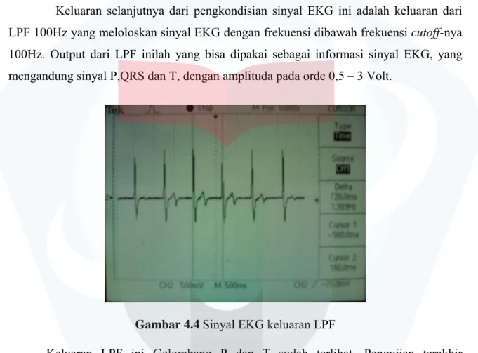 Gambar 4.3 Sinyal EKG keluaran penguat kedua 