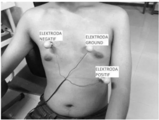 Gambar 3.  Peletakan Elektroda pada Subjek Uji 