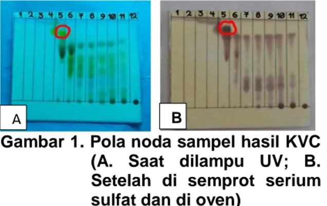 Gambar 1. Pola noda sampel hasil KVC  (A.  Saat  dilampu  UV;  B.  Setelah  di  semprot  serium  sulfat dan di oven) 