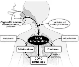Gambar 4. Patologi COPD45 