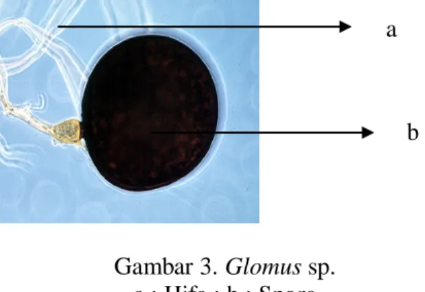 Gambar 3. Glomus sp.  a : Hifa ; b : Spora  Sumber : Dewi (2007) 