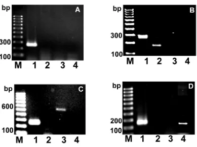 Gambar 1 .  Hasil PCR  rearrangementBCL2 pada  gen BCL2. Tanpa  rearrangement (A), rearrangement Major Breakpoint Region (MBR) (B), rearrangement BCL2 pada minor cluster region (mcr )(C) dan rearrangement BCL2 pada intermediate cluster region (icr)  (D)