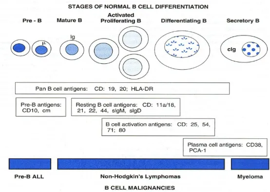 Gambar 1. Keganasan sel limfosit B dan tahap perkembangan sel 1  