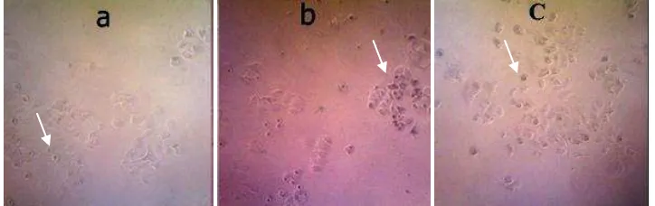 Gambar 6.  Grafik hubungan  konsentrasi ekstrak daun  pepaya (Carica papaya) dengan persen sel hidup terhadap sel MCF-7 