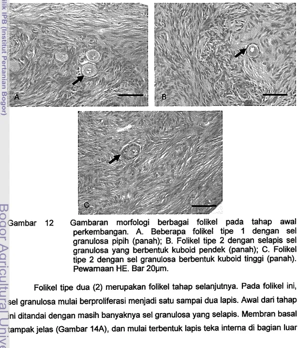 Gambar  12  Gambaran  morfologi  berbagai  folikel  pada  tahap  awal  perkembangan.  A