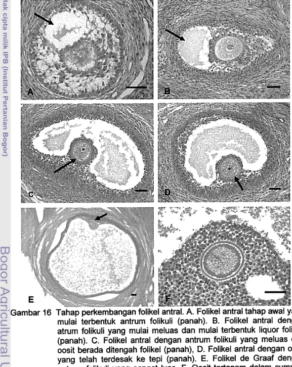 Gambar 16  Tahap perkembangan folikel antral. A.  Folikel antral tahap awal yang  mulai  terbentuk  antrum  folikuli  (panah)