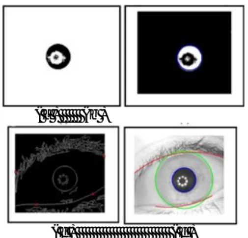 Gambar 5:Proses segmentasi iris yang baik : (a)  Gambar mata biner. (b) Deteksi pupil
