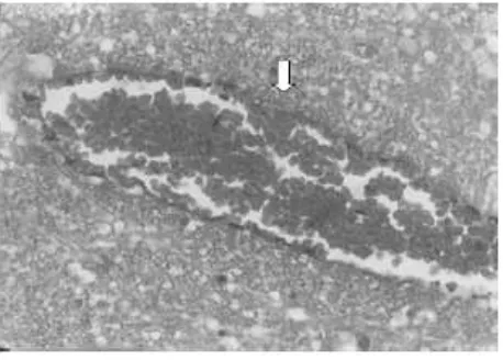 Figure 1. Malaria pigments in the capillary of the brain (H&E after bleaching X 100)    