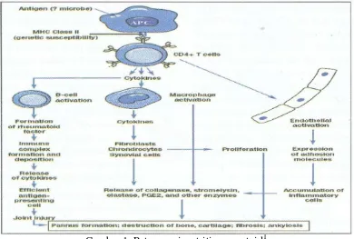Gambar 1. Patogenesis artritis reumatoid1 