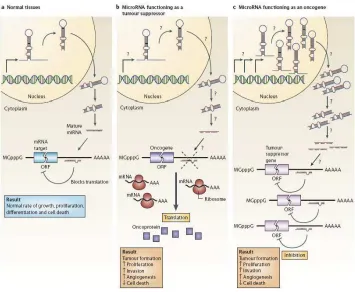 Figure 2.MicroRNAs can function as tumor suppressors and oncogenes. A. In normal tissues, proper microRNAs (miRNA) transcription, processing and binding to complementary sequences on the target mRNA results in the repression of target-gene expression throu