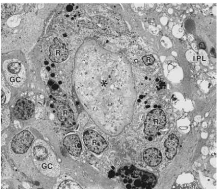 Figure 5. Electron micrograph of bone spicule pigment in retina 