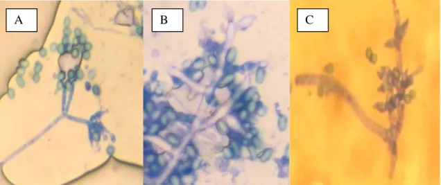 Gambar 2. Mikroskopis fungi (A) T. viridae (B) T. koningii (C) T. harzianum,        Sumber : Foto langsung pada perbesaran 40 x 10