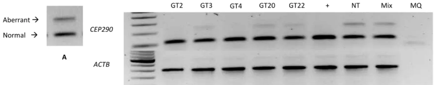 Figure 11. Transcriptional Analysis. A. CEP290-associated LCA cells showed aberrant and normal transcript  that can be assessed by PCR encompassing exon 26-27 at cDNA levels