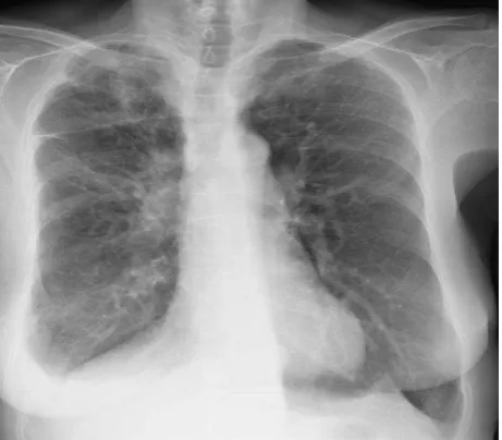 Figure 2. Post-surgery X-ray