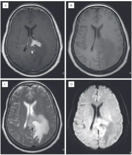 Table 2. Tumor location and characteristic (n = 25)