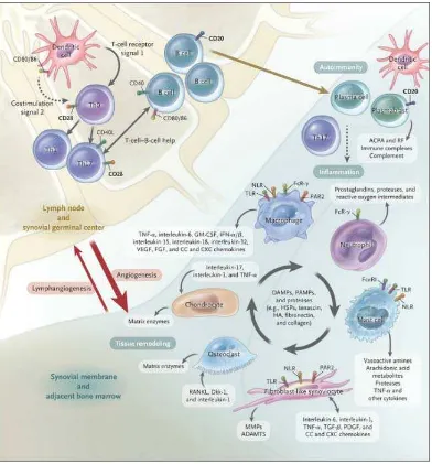 Gambar 2.7 Proses Sistem Imun dalam Sendi pada AR (McInnes & Schett, 2011) 