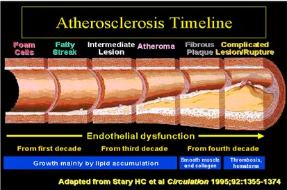 Gambar 2.  Garis waktu proses aterosklerosis 39  2.2.6. Proses Patologi Terkait Aterosklerosis 