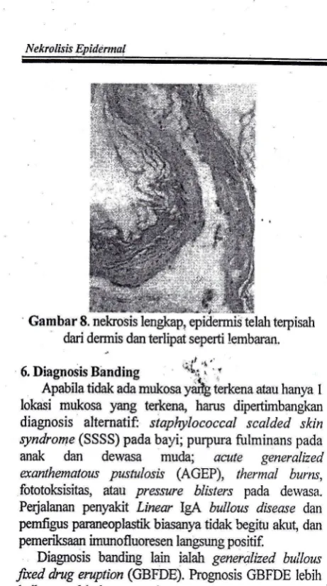 Gambar 8. nelffosis lengkap,