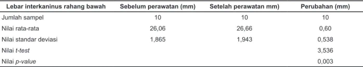 Tabel 1. Perubahan lebar interkaninus rahang bawah pada kelompok waktu aktivasi dua minggu sekali Lebar interkaninus rahang bawah Sebelum perawatan (mm) Setelah perawatan mm) Perubahan (mm)