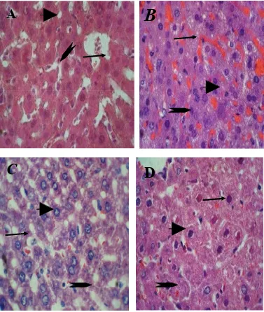 Figure 13.Histopathology feature  of liver cells  changes of SD rats after SD rats after   10  HE staining examination of   group (A,B,C,D) (400X magnification)  weeks (A)13 weeks (B )cigarette smoke exposure only,10 weeks   cigarette smoke exposure + Curc