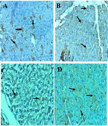 Figure 15. Morphology of for group Aexposure TNF-  expressions of liver tissue of SD  after 10  cigarette smoke exposure ,13 weeks for group B cigarette smoke  ,10 weeks for group C  cigarette smoke exposure + Curcuma L