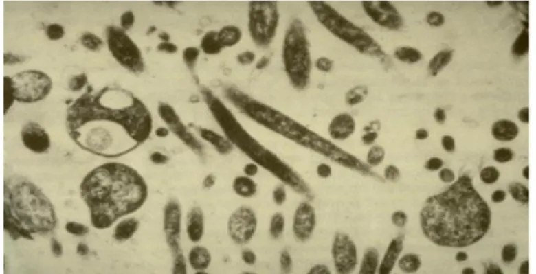 Gambar 2.4 Penyebab penyakit CVPD L. asiaticum  pada floem.  Sumber : Garnier, 2010 