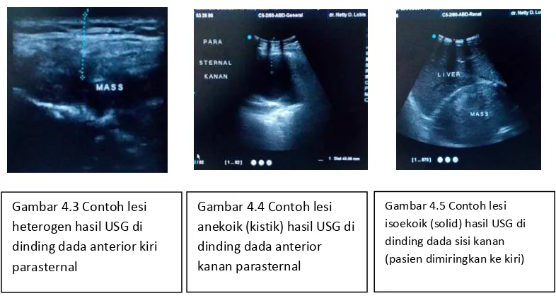 Gambar 4.3 Contoh lesi 