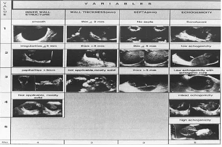 Gambar 2. Skoring morfologi sonografi menurut Sassone 