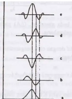 Gambar 4. Penurunan spektra normal menjadi spektra derivatif   a: spektra normal, b: spektra derivatif pertama, c: spektra derivatif kedua, d:  spektra derivatif ketiga, e: spektra derivatif keempat (Mulja dan Suharman, 1995) 