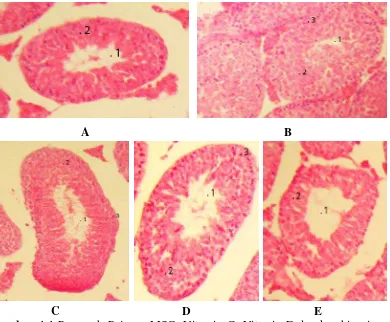 Gambar 4.4 Pengaruh Pajanan MSG, Vitamin C, Vitamin E dan kombinasinya   terhadap Histologis Tubulus Seminiferus Mencit Jantan