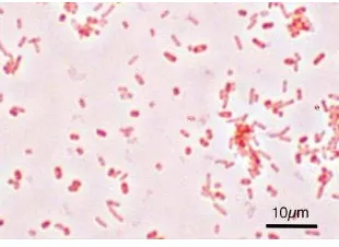 Gambar 6. Hasil pewarnaan gram Salmonella Typhimurium 