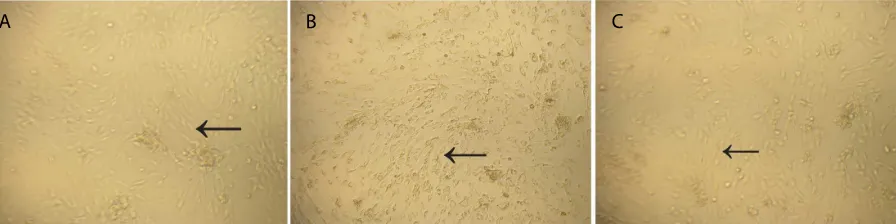 Figure 1. Cell morphology on day-3 (inverted microscope connected to Nikon camera, 200x)