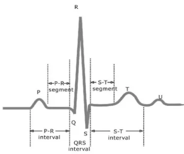 Gambar 1. Bentuk Dasar Gelombang EKG 