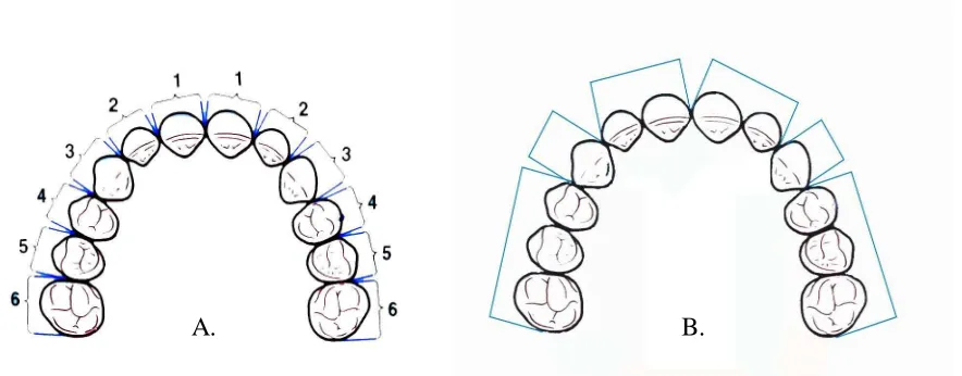 Gambar 5.   Pengukuran Arch Length Discrepancy yang melibatkan molar pertama permanen