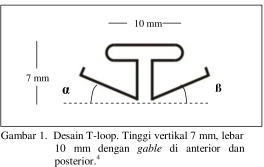 Gambar 1.  Desain T-loop. Tinggi vertikal 7 mm, lebar 