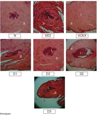 Gambar 2. Struktur histologi kelenjar mamae tikus betina dewasa yangdiovariektomi setelah perlakuan 16 hari (perbesaran 100 x)