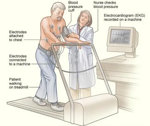 Gambar 5. Proses pemeriksaan secara stress echocardiography 