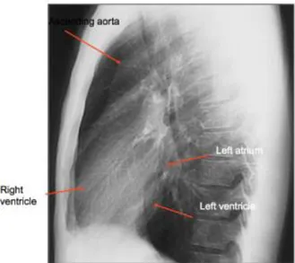 Gambar 5. Radioanatomi jantung lateral 