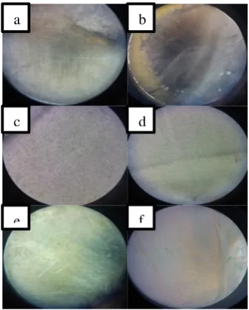 Figure 3. Stereo microscope characterization images of Ti-6Al-4V surface with (a) anodization and (b) without anodization